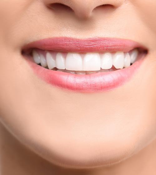 a person smiling with bright teeth after dental bonding