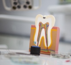 Model of a healthy tooth