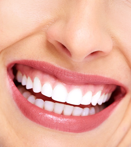 Healthy smile after fluoride treatment
