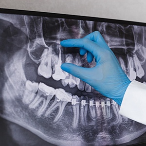 dentist explaining X-ray to patient