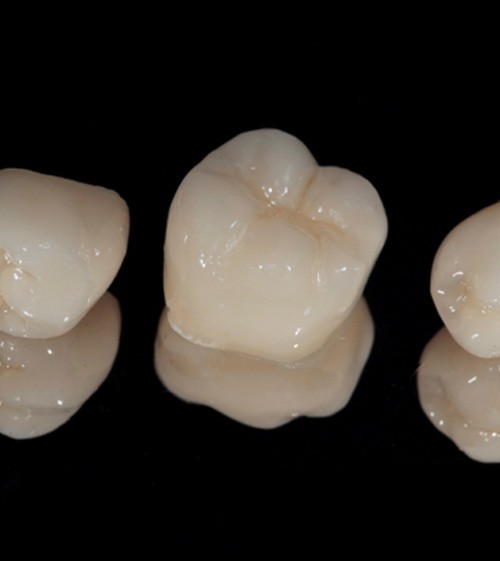 Three CEREC same-day dental crowns in North Grafton, MA sitting in a row
