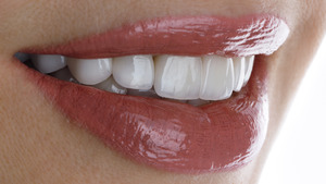Close-up of a woman’s lips and teeth